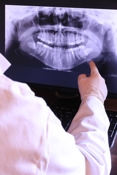 Best Emergency Dental Care for Abscessed Tooth in Adel, GA