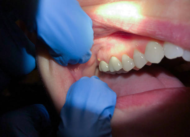 Best Emergency Cosmetic Dentistry in Adel, GA