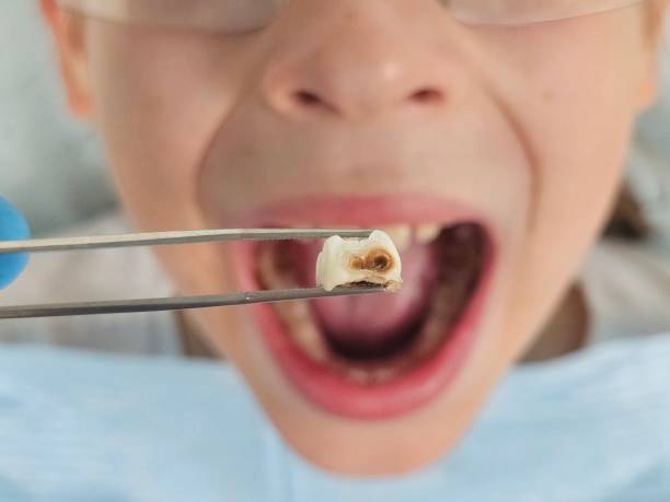 Best Urgent Dental Care for Toothache in Adel, GA
